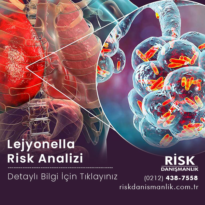 Lejyonella Risk Analizi