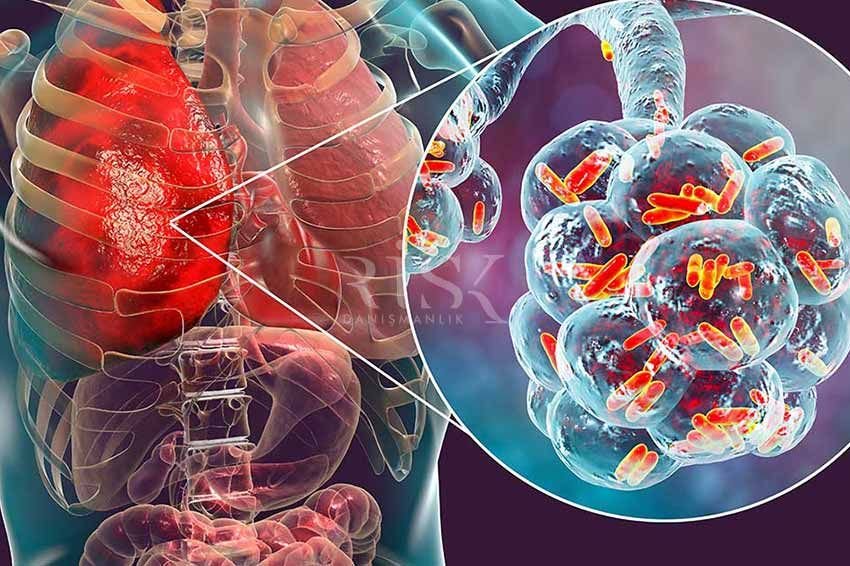 Lejyonella Risk Analizi - Risk Danışmanlık